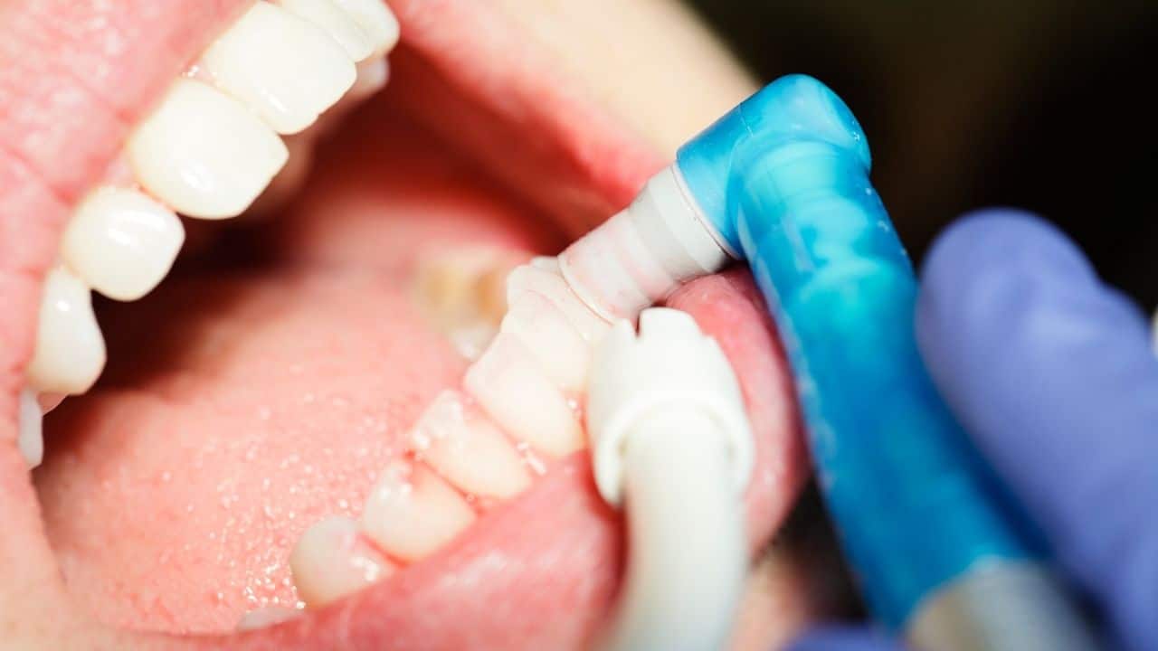 רופא שיניים בהרדמה כללית או בגז צחוק?
