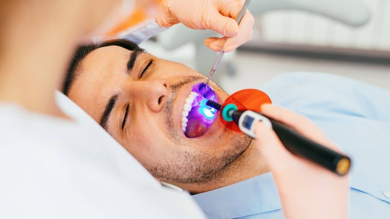הלבנת שיניים בלייזר - הסיבות לטיפול