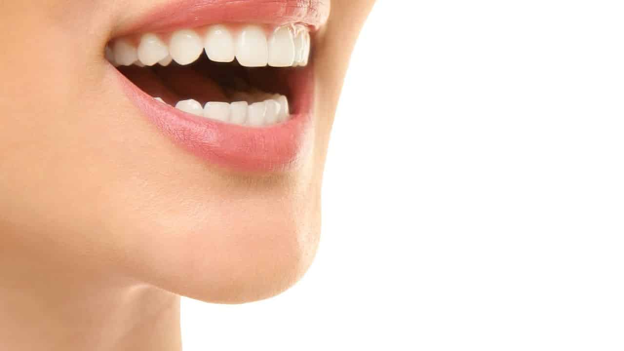 הלבנת שיניים בלייזר טיפול