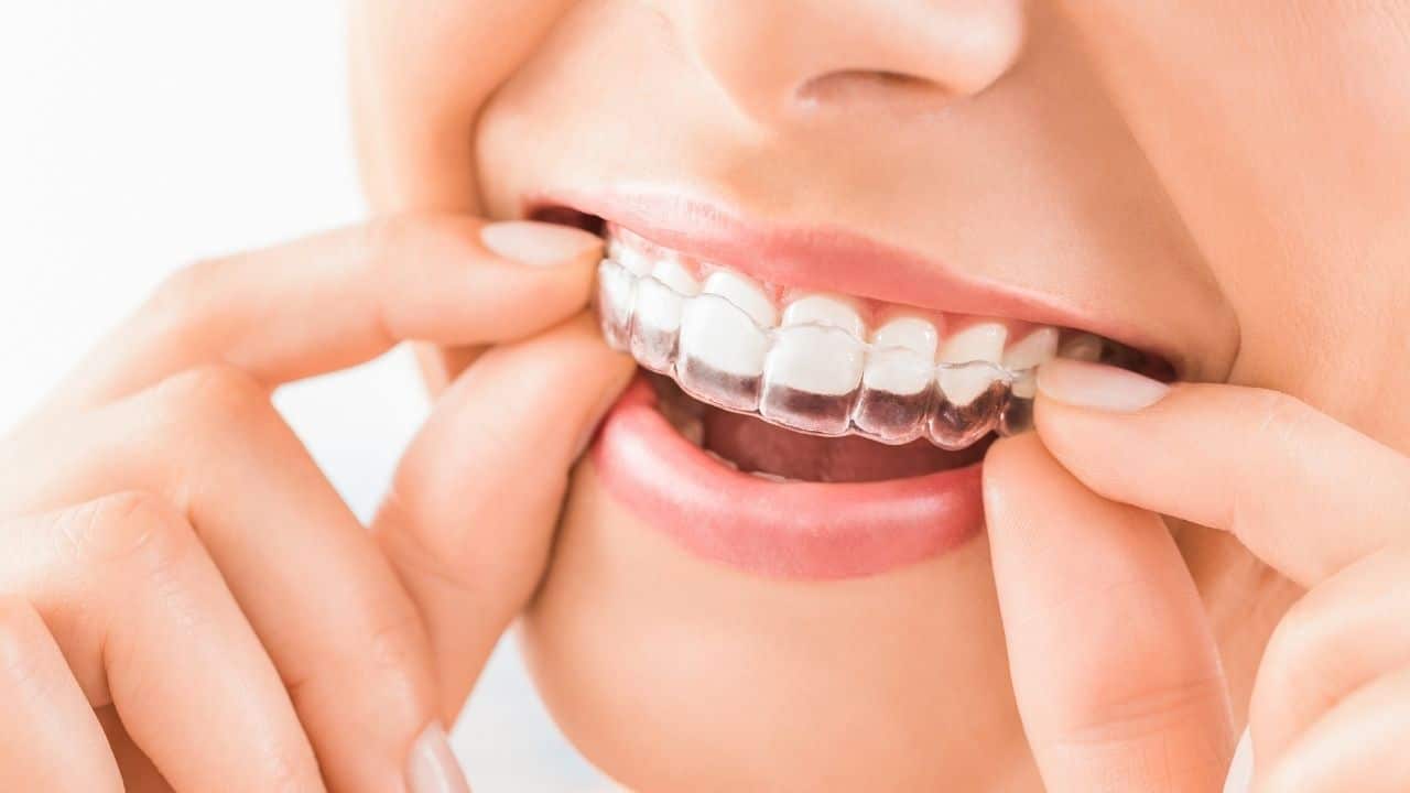 יישור שיניים אינוזליין