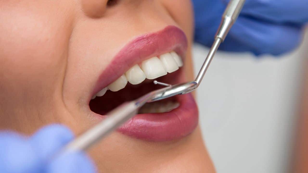 תהליך עיצוב השיניים במרכז לאסתטיקה והשתלות שיניים